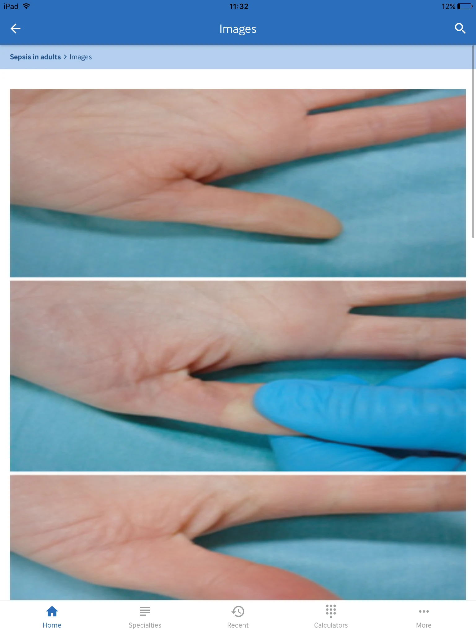 BMJ Best Practice screenshot